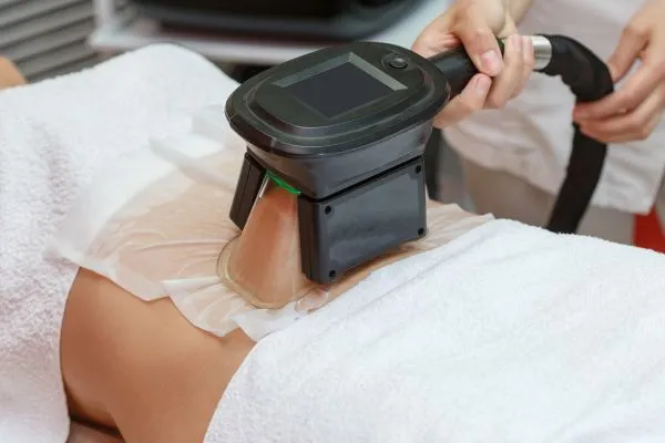 Image of person having fat freezing treatment to help weight gain Leicester