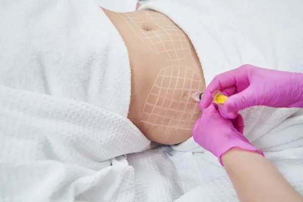 image of fat dissolving injections on love handles to help combat weight gain Leicester