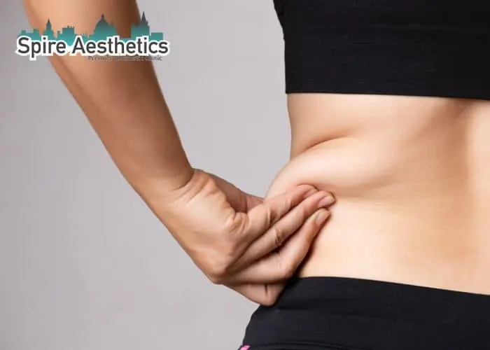 Image of woman pinching fat on their hips Leicester. Fat Freezing treatment 
