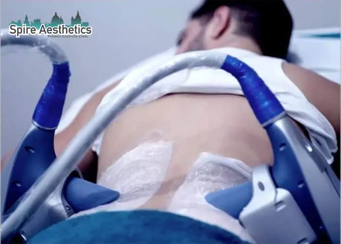 Man having fat freezing treatment done on love handles before a competitions Leicester to create a sculpted look.