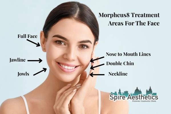 Where can Morpheus8 Treatment Leicester be done on the body?