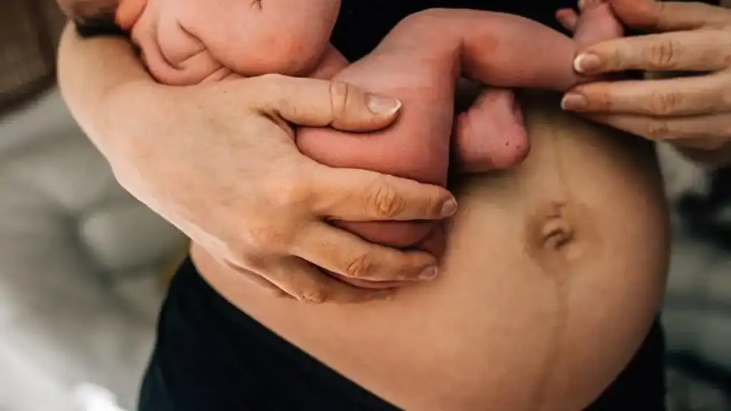 Why Is My Stomach Still Big After Pregnancy Leicester?